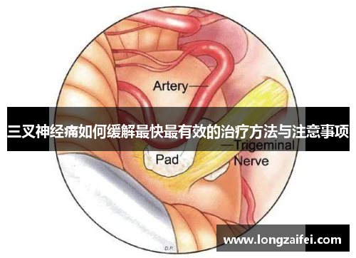 三叉神经痛如何缓解最快最有效的治疗方法与注意事项